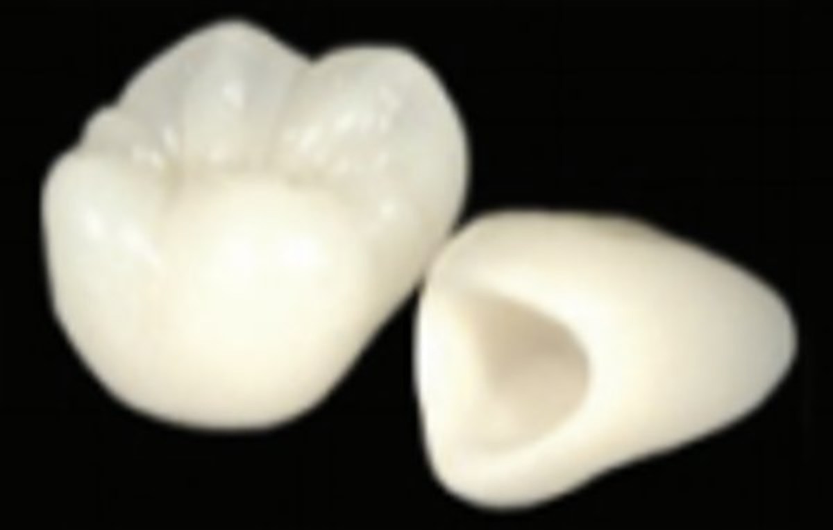 ジルコニアクラウン